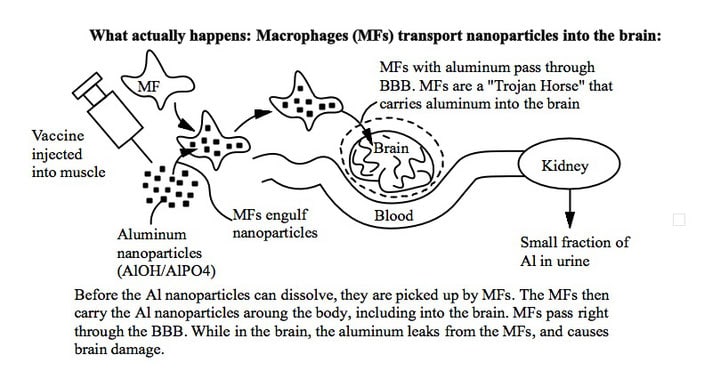 So wandert das Impf-Aluminium ins Gehirn:Makrophagen schleusen als Trojanisches Pferd Aluminium-Nanopartikel durch die B...