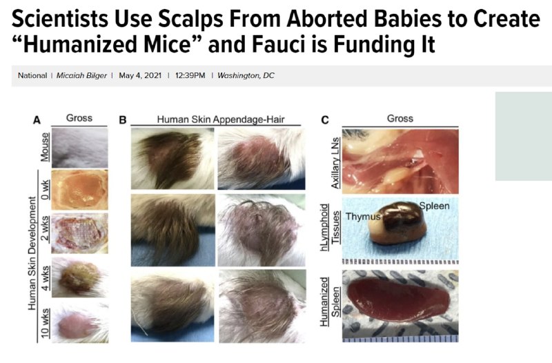 Wissenschaftler verwenden Skalps von abgetriebenen Babys, um "humanisierte Mäuse" zu züchten und Fau...